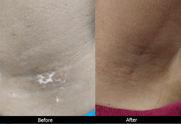 Best skin specialist in lucknow