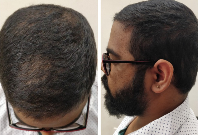  skin specialist in lucknow