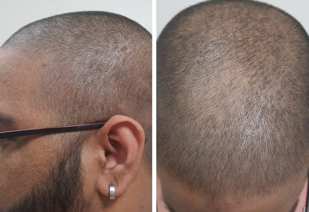 skin specialist in lucknow